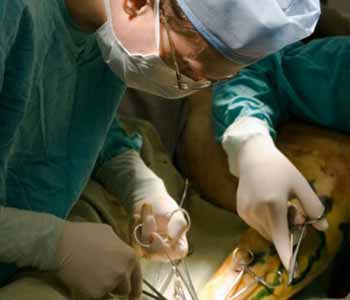 Vasectomy Reversal Cost