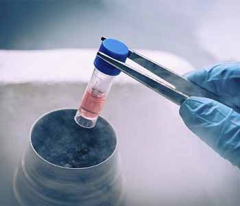 Frisco sperm bank offers semen cryopreservation